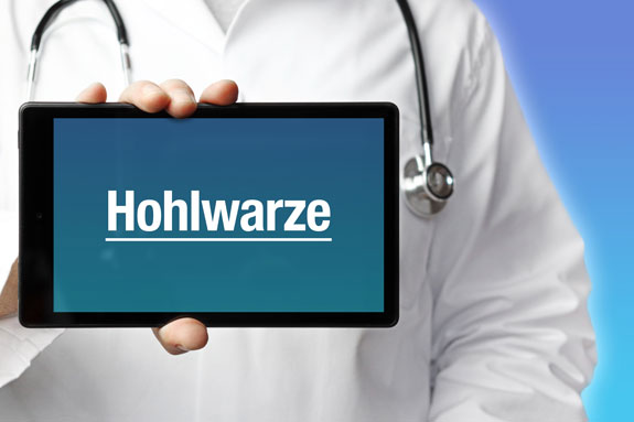 Schlupfwarzen Erfurt